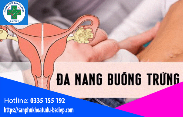 bieu-hien-da-nang-buong-trung biểu hiện của đa nang buồng trứng