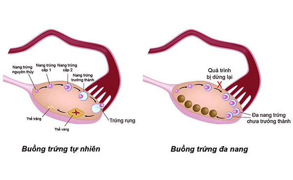 buong-trung-da-nang-co-rung-trung-khong