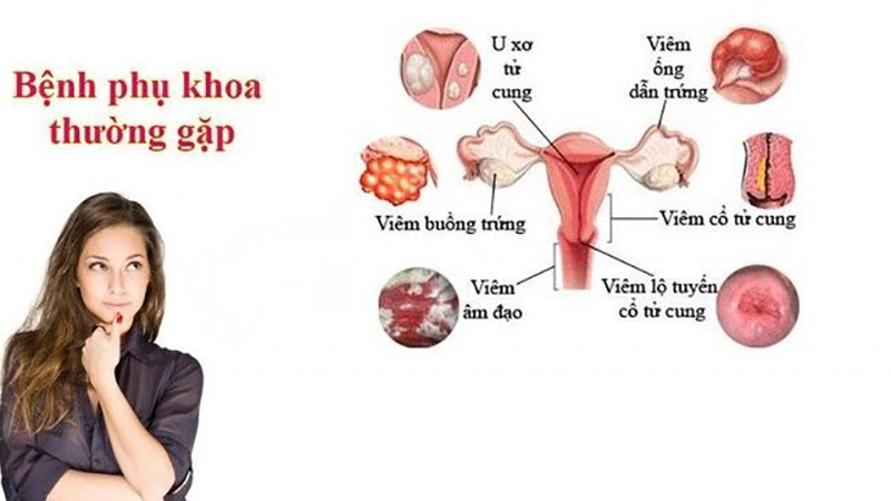 cac-benh-phu-khoa-thuong-gap Mất kinh nguyệt là dấu hiệu bệnh phụ khoa