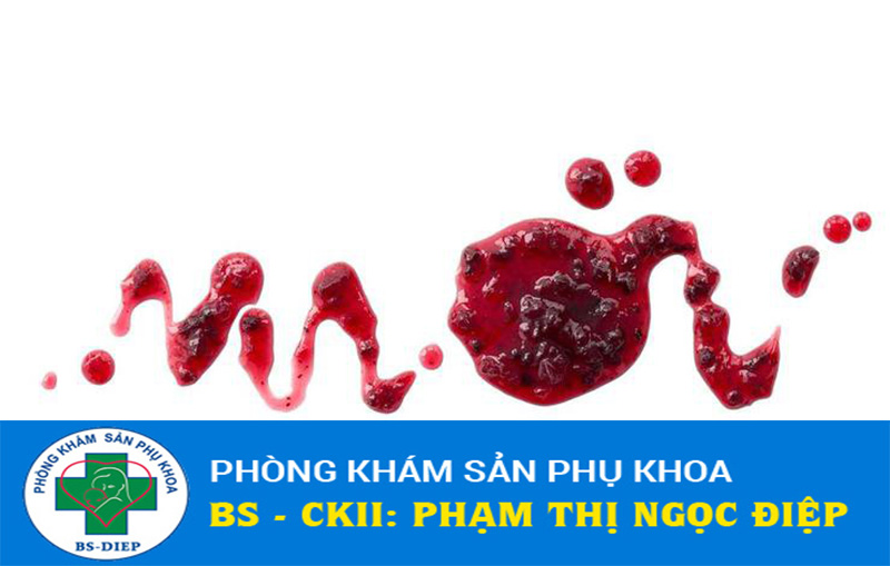 cac-dau-hieu-say-thai-1 dấu hiệu sảy thai sớm khi chưa vào tử cung