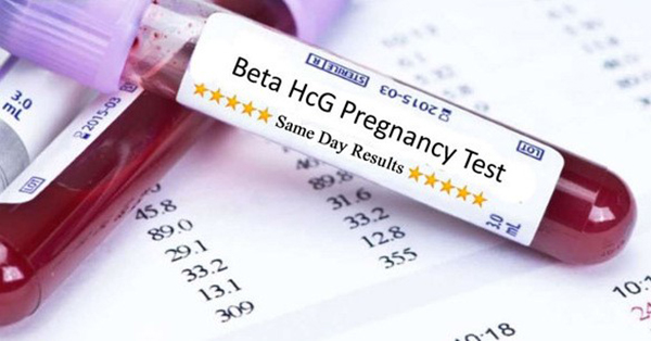 chi-so-hcg-thai-ngoai-tu-cung Chỉ số HCG thai ngoài tử cung