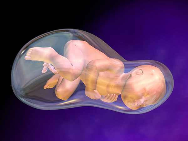 da-oi-co-nen-mo-som-khong Đa ối có nên mổ sớm không