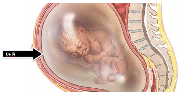 da-oi-co-nguy-hiem-khong Mẹ đa ối tuần 37 có nguy hiểm gì không?
