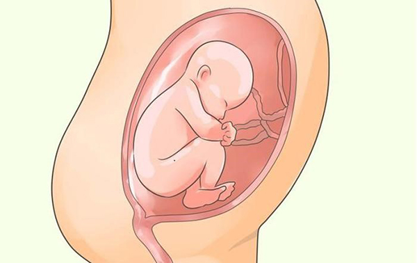 da-oi-co-nguy-hiem-khong1 Mẹ bầu bị đa ối thường được chỉ định sinh luôn vào tuần 36, 37 khi bé đã phát triển hoàn thiện