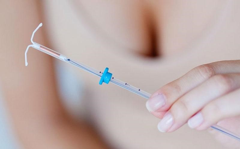 dat-vong-tranh-thai Thực hiện thủ thuật đặt vòng tại Sản phụ khoa Từ Dũ Bác sĩ Điệp