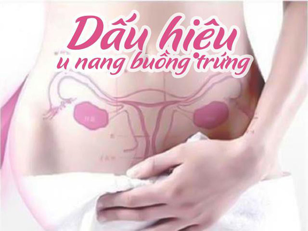 dau-hieu-u-nang-buong-trung Dấu hiệu u nang buồng trứng