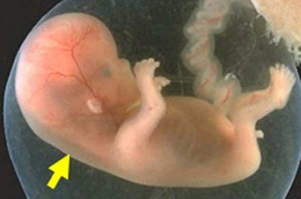 do-do-mo-da-gay-2 đo độ mờ da gáy