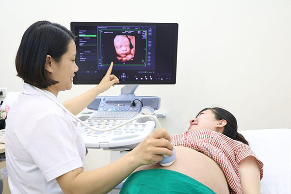 gia-sieu-am-4d-2 Giá siêu âm 4d