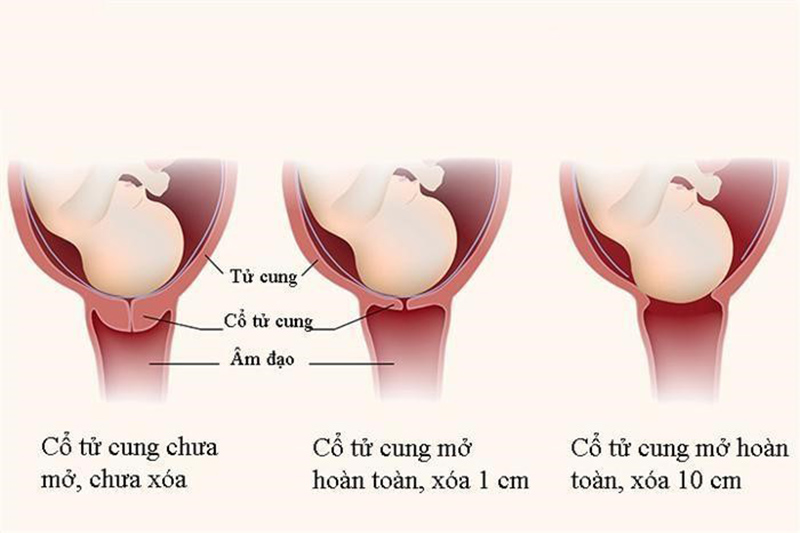 giai-doan-dau-me-bau-phai-vuot-qua Giai đoạn đau mẹ bàu phải vượt qua