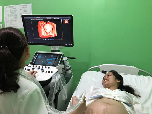Siêu âm 4D