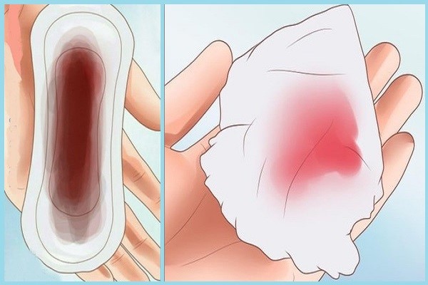 kinh-nguyet-ra-nhieu Kinh nguyệt ra nhiều