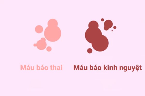 mau-bao-thai-khac-mau-kinh Máu báo thao khác máu kinh