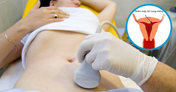 niem-mac-tu-cung-mong-do-phau-thuat Lớp niêm mạc mỏng cũng có thể là biến chứng của phẫu thuật tử cung