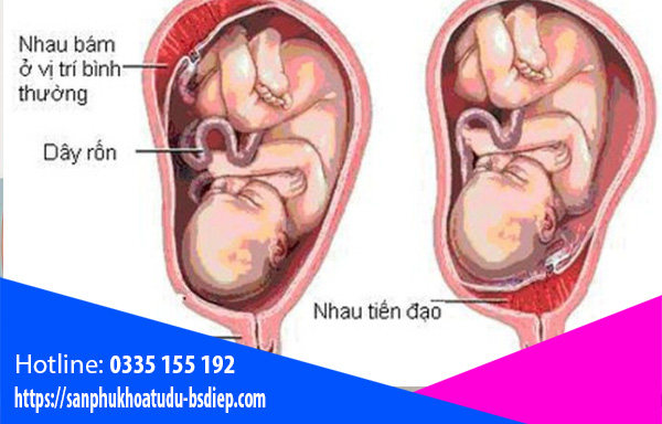 rau-tien-dao Rau tiền đạo
