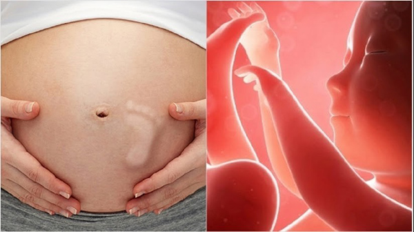 thai-may-la-gi1 “Thai máy là gì?” là thắc mắc chung của những mẹ bầu mang thai con đầu lòng