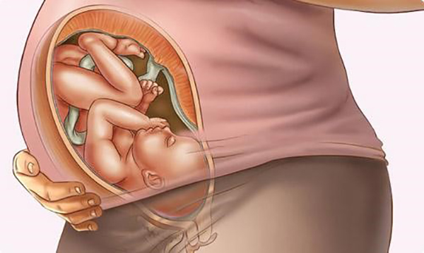 thai-nhi-38-tuan-mo-duoc-chua Thai nhi 38 tuần mổ được chưa