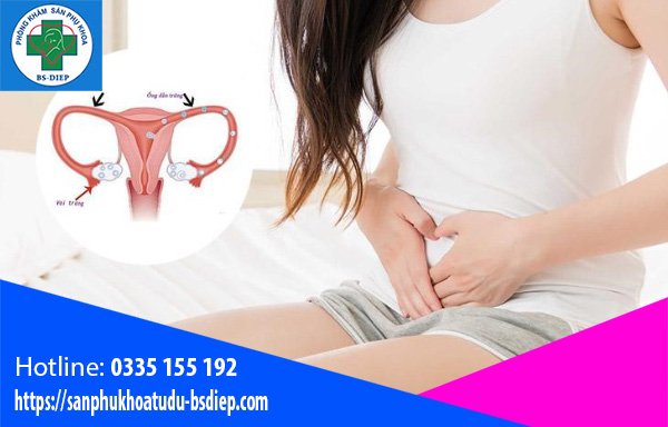 Thắt ống dẫn trứng gây tác dụng phụ
