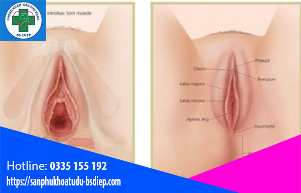 thu-hep-am-dao Thu hẹp âm đạo