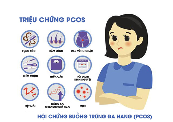 trieu-chung-buong-trung-ba-nang Bạn có thể nhầm lẫn triệu chứng buồng trứng đa nang với một số căn bệnh khác