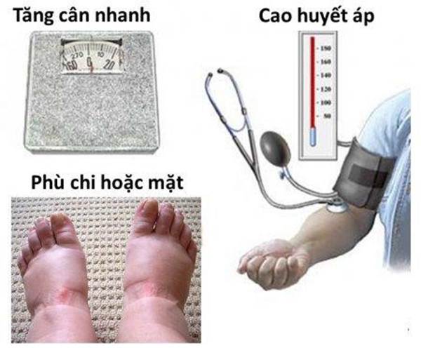 trieu-chung-tien-san-giat Triệu chứng tiền sản giật