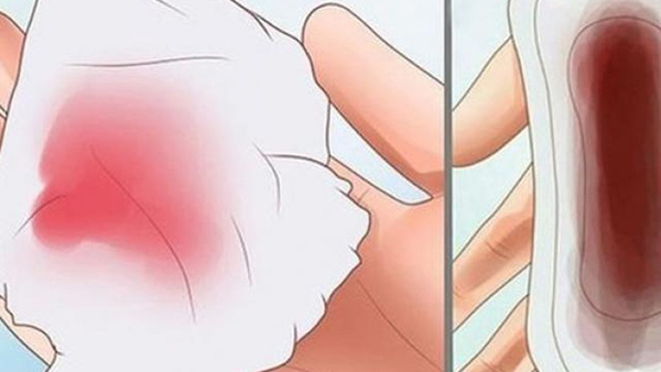 tu-cung-ra-mau-bat-thuong Tử cung ra máu bất thường
