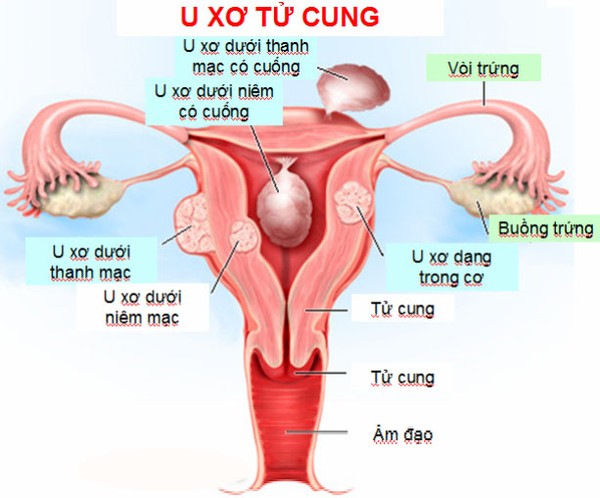 U Xơ