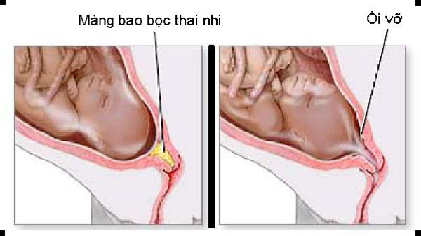 Vo oi trong Thai Kỳ