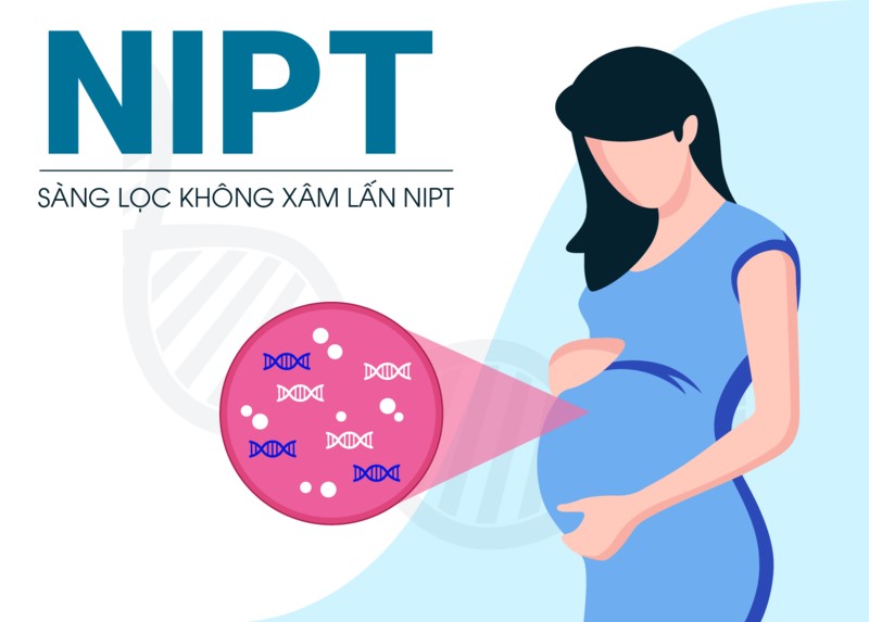 xet-nghiem-nipt Xét nghiệm Nipt
