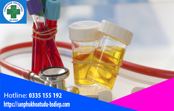 xet-nghiem-nuoc-tieu Xét nghiệm nước tiểu