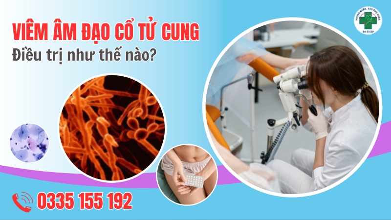 điều trị viêm âm đạo