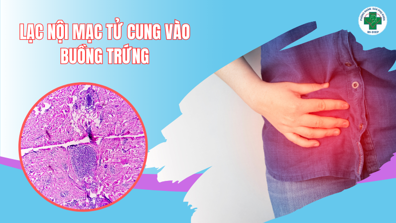 U Nang
